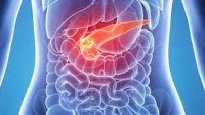 علماء يبتكرون بروتين هجين صناعي للكشف السريع عن علامات مرض السرطان