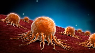 دراسة حديثة: السكريات المصنعة تزيد من إحتمالية الإصابة بالسرطان 