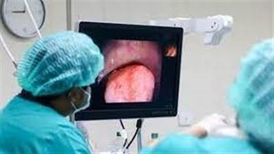 سرطان القولون.. أكثر أمراض السرطان شيوعًا (كيفية اكتشافه)