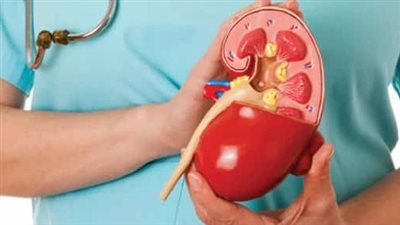 دراسة تطور علاجا أقل إيلاما في تفتيت حصوات الكلى وبسرعة أكبر من العلاجات الحالية