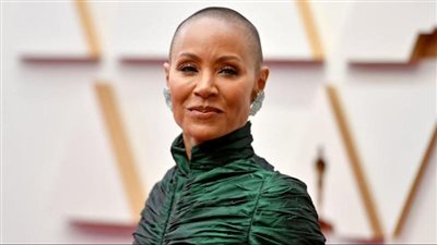 بعد ظهور جادا بينكيت سميث.. هكذا تتعايش نساء شهيرات مع الثعلبة