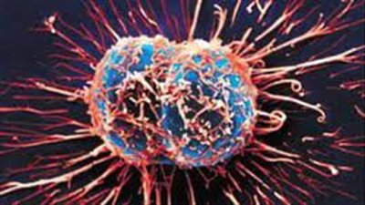 علماء: للخلايا السرطانية أقداما كاذبة للحركة