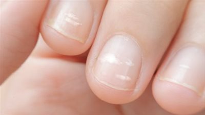 هل يمكنك تناول المكملات الغذائية لصحة الأظافر؟