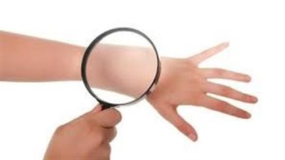  دراسة تتوقع ارتفاع حالات الإصابة بسرطان الجلد عالميا بنسبة 50% بحلول عام 2040