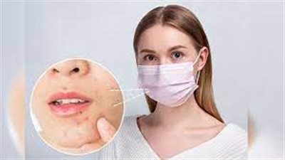  4 نصائح لتجنب الحكة والالتهاب