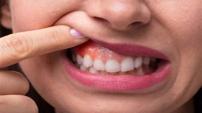 كيف تعد صحة الفم مؤشرا هاما على الصحة العامة؟