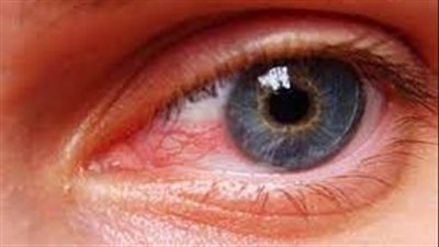 ما هي أمراض المناعة الذاتية التي يمكن أن تؤثر على الرؤية؟