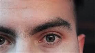 تورم الأكياس الدمعية له أسباب عدة.. ما هي؟