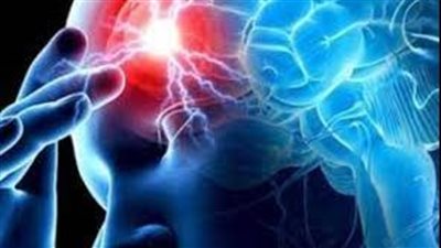 خبراء يكشفون عن مواد غذائية تنظف الشرايين وتقي من السكتة الدماغية