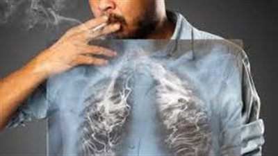  دراسة جديدة: بعض المدخنين لديهم آليات تحميهم من أورام الرئة 