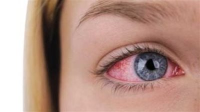 أعراض خطيرة تظهر على العين بعد الإصابة بفيروس كورونا