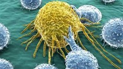  دراسة تكشف عن الآلية التي تستخدمها خلايا السرطان لتتمكن من تنويم المناعة