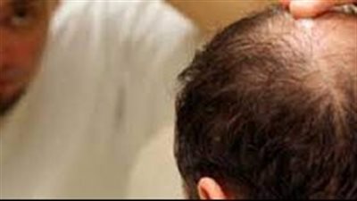 باحثون ينجحون في تحديد الإشارات الجزيئية التي تحفز تكوين بصيلات الشعر وتجديدها