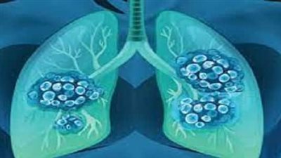  الخبراء يشيدون بـ 