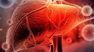 ما هي تفاصيل انتشار التهاب الكبد الحاد الوخيم 