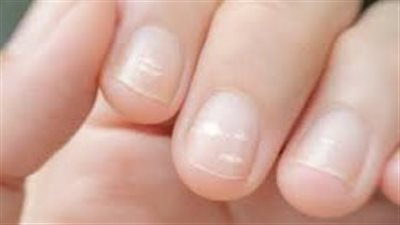 أسباب التغييرات التي تطرأ على بشرتك أو أظافرك