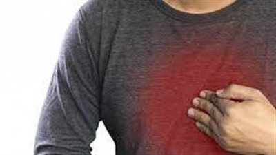  الأطعمة التي يمكن أن تؤدي إلى حرقة المعدة