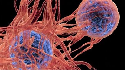 خبراء: التعب الشديد والسعال أحد علامات الإصابة بالسرطان