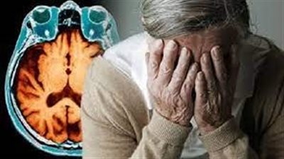 سبب ظهور الأعراض العصبية والنفسية مثل اللامبالاة.. وتطور مرض الزهايمر