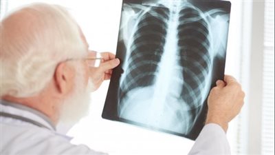 الأشعة يمكن أن يكون مفيدا في حالات معينة.. ما هي؟