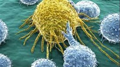 أسباب الإصابة بالسرطان