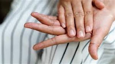 هل لون الأظافر يكشف ارتفاع نسبة الكوليسترول؟
