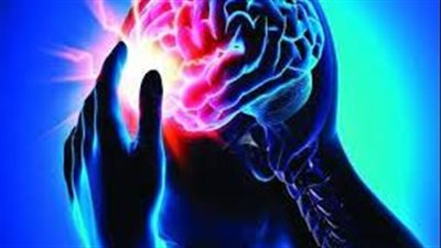  سبب اضطرابات سريان الدم في الرأس.. تعرف عليه