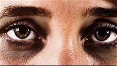 تعرف على الحلول السحرية للهالات الداكنة حول العين!