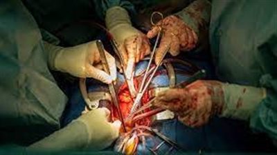 معلومات جديدة حول قلب الخنزير المعدّل وراثيًا الذي زرع لرجل فارق الحياة