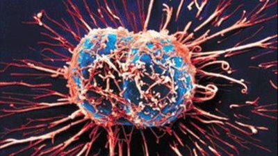 علماء يبتكرون علاجًا جديدًا لسرطان الثدي والبروستاتا من بكتيريا التربة