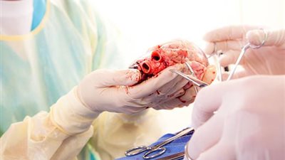 خبراء: الرجل الذي زرعوا في جسمه قلب خنزير معدل كان مصابا بفيروس الخنازير