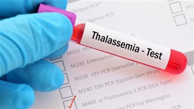 ما لا تعرفه عن مرض الثلاسيميا