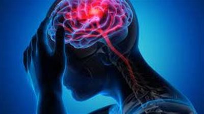 علاقة وثيقة تربط بين الإصابة بسكتة دماغية وارتفاع ضغط الدم