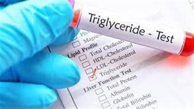 ما هي طرق طبيعية لتقليل مستوى الدهون الثلاثية في الجسم؟
