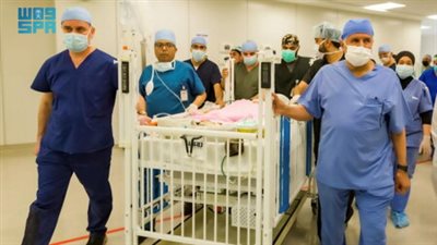 غداة عملية لفصلهما.. وفاة أحد توأمين يمنيين سياميين في المملكة