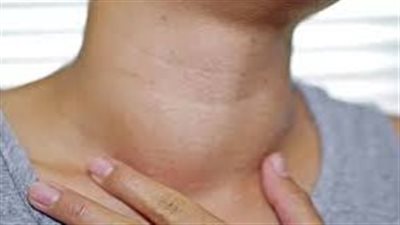 طبيب روسي يكشف عن الأمراض التي يشير لها التهاب العقد اللمفاوية في الجسم