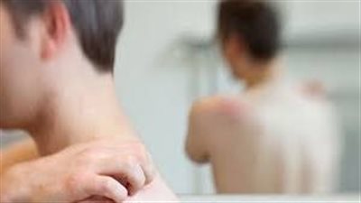 أسباب الإصابة بحساسية الهستامين