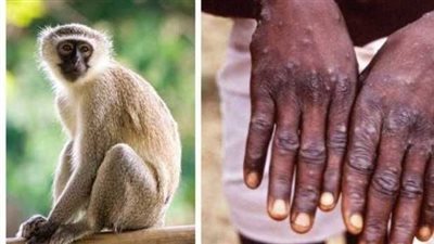 وزير الصحة اللبناني يكشف عن عدم وجود أي حالة من 