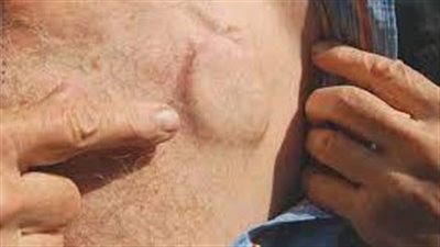 خبراء يبتكرون مصدرا دائما للطاقة لأجهزة تنظيم ضربات القلب 