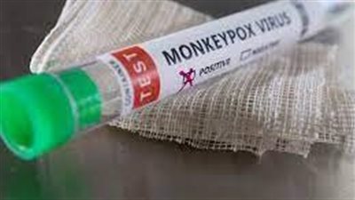  الدنمارك واسكتلندا يعلنان تسجيل أول إصابتين بمرض جدري القردة