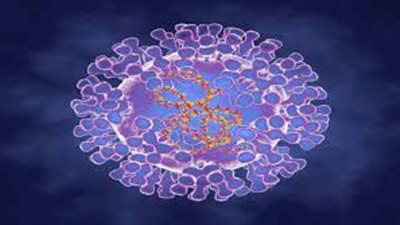 خبير روسي يقيّم احتمال انتشار جدري القردة.. ويؤكد أنه أخف من مسار جدري البشر