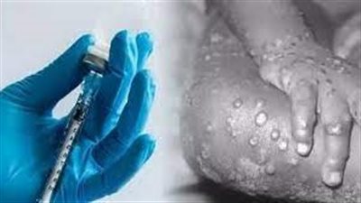 تقرير يكشف ارتفاع عدد الإصابات بجدري القردة في إسبانيا والبرتغال