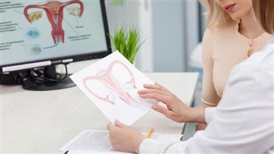 كل ما تريد معرفته حول أعراض سرطان عنق الرحم 