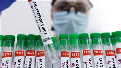 روش تعمل على تطوير ثلاث مجموعات اختبار للكشف فيروس جدري القردة 