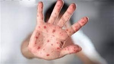 الولايات المتحدة تفرج عن جزء من مخزون لقاح لـ 