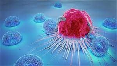  الولايات المتحدة تنفق على رعاية مرضى السرطان ضعف متوسط ما تنفقه الدول المتقدمة الأخرى