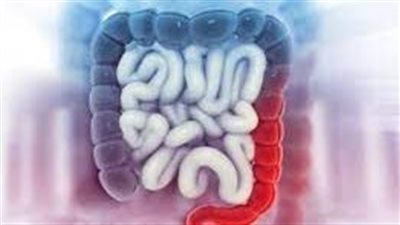 أسباب زيادة خطر الإصابة بسرطان القولون والمستقيم