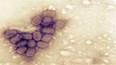 أفضل طريقة لتجنب فيروس Powassan 