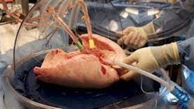 كيفية استعادة وظيفة الرئتين المصابتين بالمرض بشكل منفصل