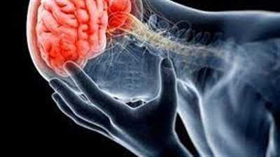 ما هي أعراض ارتجاج الدماغ؟.. دراسة توضح